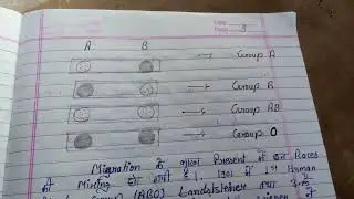 History and Discovery of blood group system in Hindi #Types of blood group#blood group system