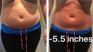 Cryotherapy for fat & inch loss at Cinch Clinic, Holywood, Northern Ireland