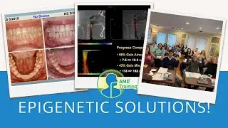 Dentist, Heal Thyself! Impaired Mouth-Airway-Sleep Axis Treated With Painless Epigenetic Solution