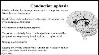 Disconnection syndromes د علاء مشعل