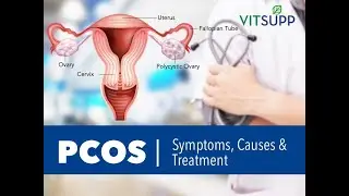 Navigating PCOS: Understanding, Managing, and Thriving #shortsviral #short
