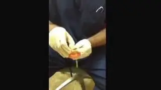 Dental Treatments, Explained by Dr. Aaron Choroomi