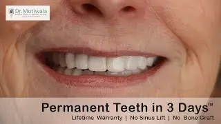 Sue from Carolina, USA shares her experience of full mouth dental implants in India | Dental Tourism