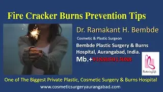Burns Prevention, Precautions , Tips & Primary Aid during enjoying Fire crackers in Diwali