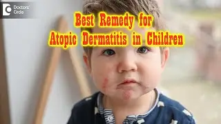Pediatric Atopic Dermatitis | Can this progress to adult stage?- Dr. Rasya Dixit | Doctors' Circle
