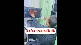 আপনার কিডনিতে পাথর আছে কিনা তা জানতে কি করবেন  #dr_joynal_abdin #shortvideo