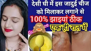 देसी घी में यह मामूली सी चीज मिलाकर पुराने से पुराने झाइयां दाग धब्बे 1 बार में जड़ से गायब 100%work