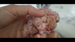 En Kolay Beyin Haşlama Nasıl Yapılır | Beyin Nasıl Pişirilir |Sakatat