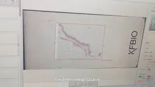 KFBIO 400 SLIDES DIGITAL PAPTHOLOGY SCANNER