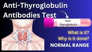 ATAB Test | Anti-Thyroglobulin Antibodies Test - Meaning, Symptoms, Normal Range