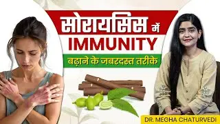 सोरायसिस में Immunity बढ़ाने के जबरदस्त तरीके | Tips to Boost Your Immunity