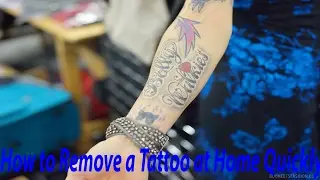 How to Remove a Tattoo at Home Quickly