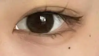 ⋆✮ Mole under right eye