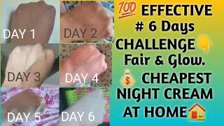 6 Days Challenging 😱 Cheapest Home Made👉  DIY Night Cream