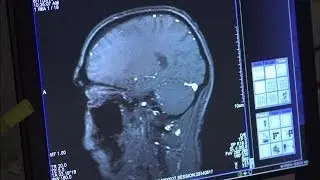 Connecting strength and vulnerability of the creative brain