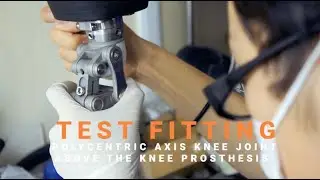 Test Fitting of Polycentric Axis Knee Joint for 3D Printed Above the Knee Prosthesis