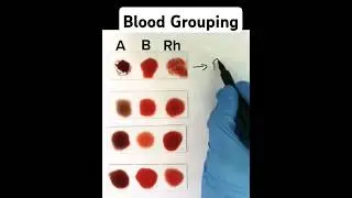 Blood Grouping made easy