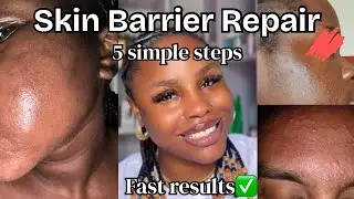 How to Repair Your Damaged Skin Barrier FAST | Full Routine Guide 2025 #skinbarrier #skincare