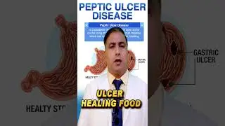 ULCER HEALING FOOD //अल्सर ठीक करने वाला भोजन