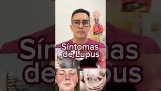 S&iacute;ntomas del lupus que no debes ignorar. #medicina #shorts