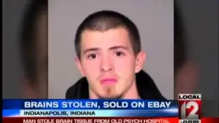 Brains Stolen and Sold on Ebay