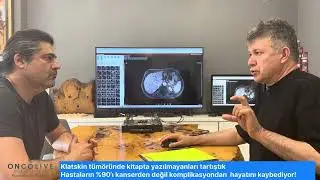 Klatskin Tümöründe Kitapta Yazılmayanları Tartıştık | Prof. Dr. Ünal Aydın