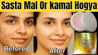 Face Fresh Cream Side Effects Exposed! Full Truth & Honest Review