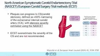Hidden Alerts Within Your Artery Walls: A Deep Dive into IMT and Plaque [경동맥 내막중막두께와 플라크]