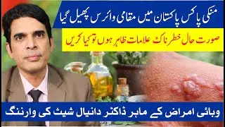 Monkeypox Virus Spreading in Pakistan | Warning Signs & Expert Alert | Dr.Daniyal Shace