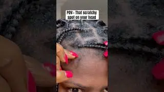 That scratchy spot on your head😩😩 #shortsfeed #trendingshorts #viralshort
