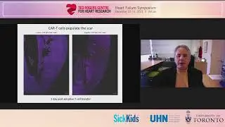 Jonathan Epstein - mRNA-mediated Immunotherapy for Heart Failure