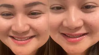 Lip Plumper Review