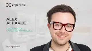 Injerto capilar antes y despu&eacute;s: el cambio de Alex te dejar&aacute; sin palabras 😮