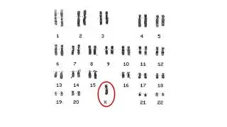 Chromosome Analysis