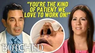 Dr. Nassif Transforms Jessa&rsquo;s Nose After Being Smashed In A Fatal Car Accident | Botched | E!