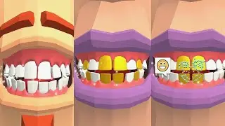 Dentist Bling Game | Max New Level | Mobile Gameplay | Zavro Games |