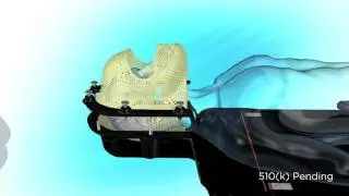 Hyper Arc video