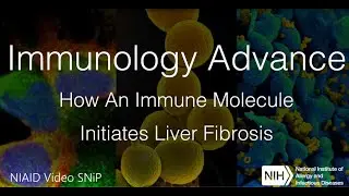 Immunology Advance: How An Immune Molecule Initiates Liver Fibrosis