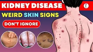 TOP BEST FOODS TO IMPROVE KIDNEY FUNCTION II KIDNEY DISEASE PREVENTION