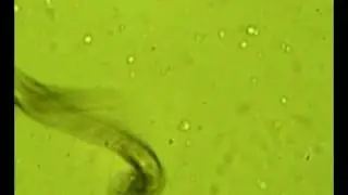Gyrodactylus