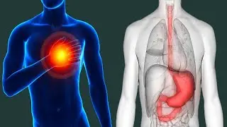 Gas Pain In The Chest: Causes And Prevention