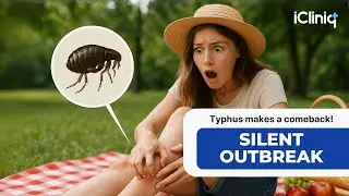 Flea Bites Can Be Dangerous?! Murine Typhus Is Back in the U.S. | iCliniq