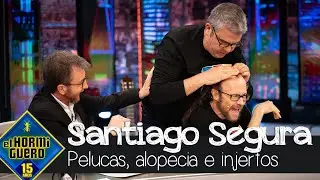 Santiago Segura habla de pelucas, alopecia e injertos ¿Se ha planteado ir a Turquía? - El Hormiguero