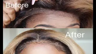 How to Repair a BALD FRONTAL/ MAKING BABY HAIRS