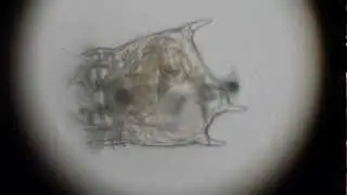 Platyias patulus