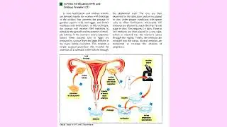 Birth control: IVF and ET d3 ch16