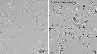 E. coli forms spheroplasts upon Imipenem treatment - &beta;-lactam-induced cell burst