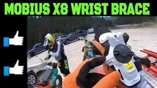 MOBIUS X8 WRIST BRACE REVIEW