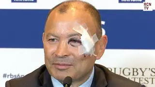 England Eddie Jones Interview - Rugby High Tackles Problems