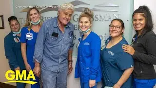 Jay Leno released from hospital after suffering severe burns l GMA